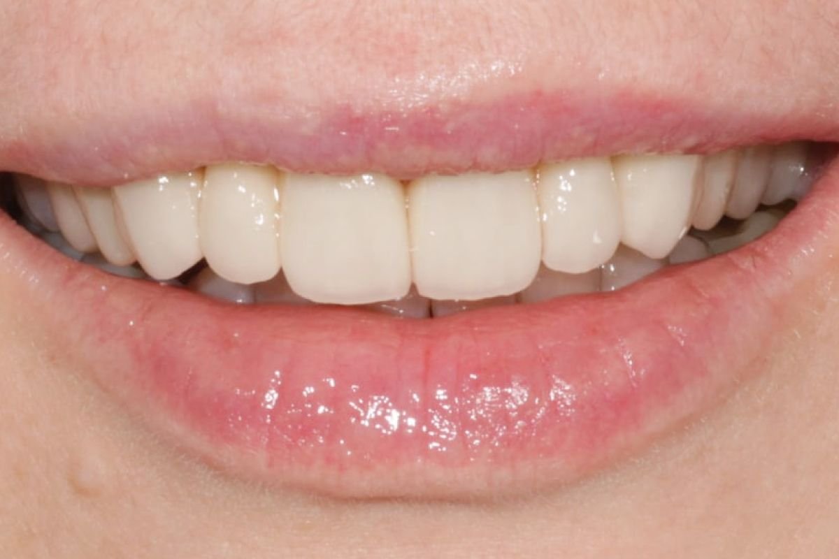 Before image